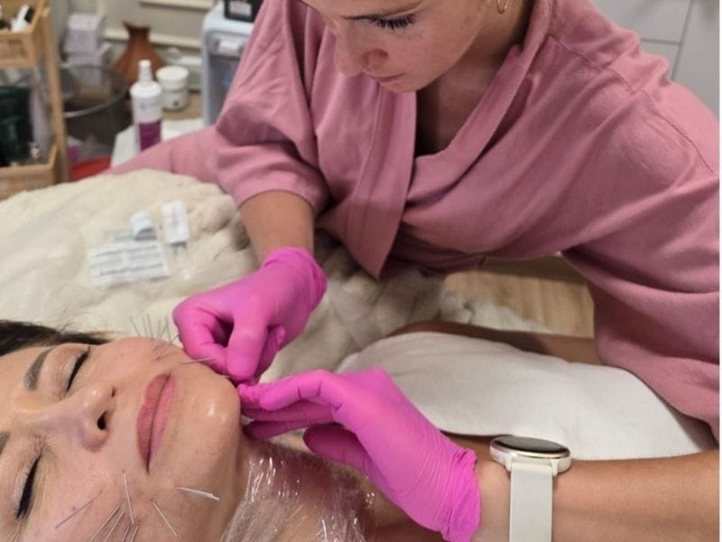 Efekty Needle Shaping